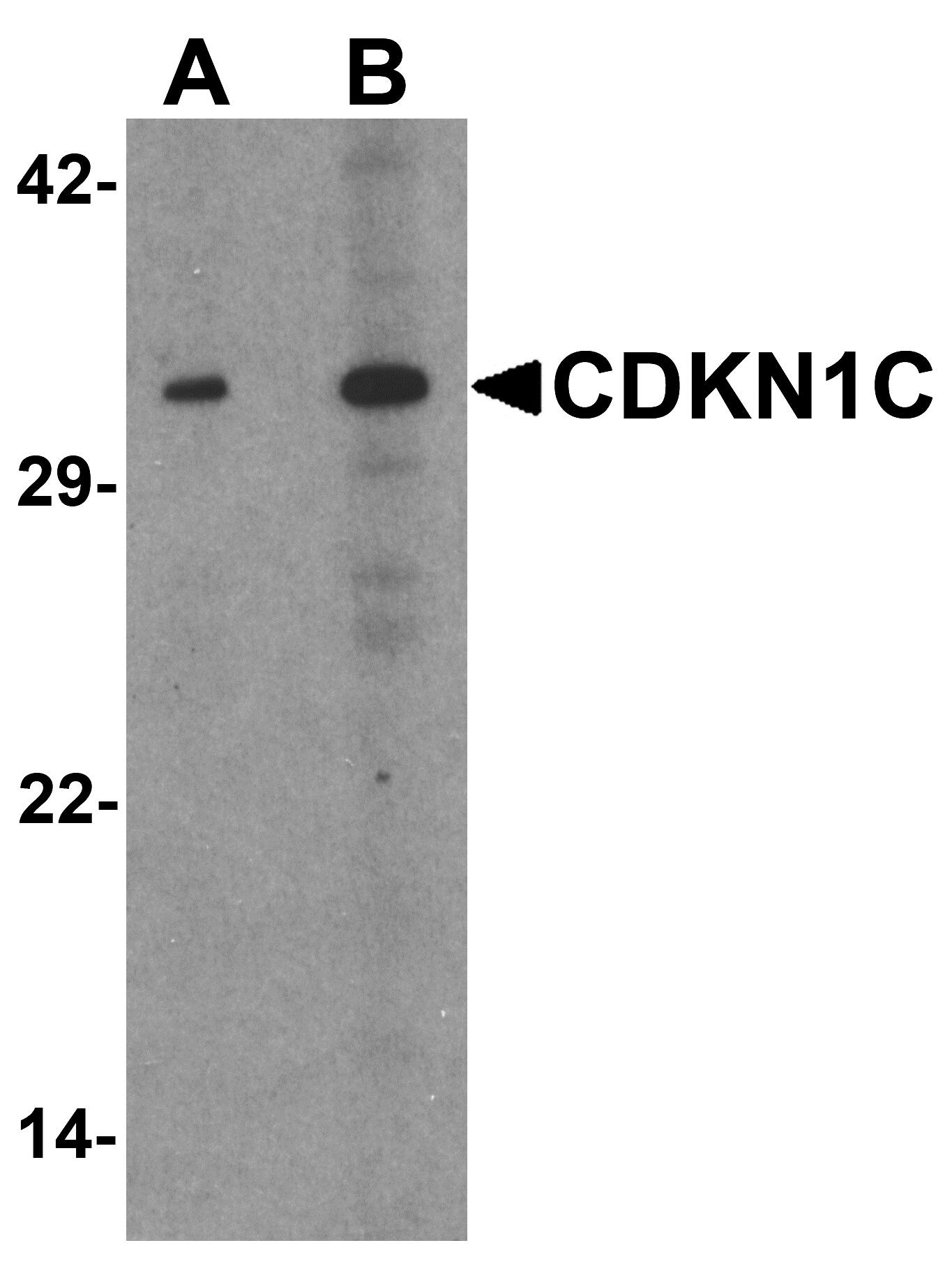 Western Blot: p57 Kip2 Antibody [NBP3-27877] - Western blot analysis of p57 Kip2 in 293 cell lysate with p57 Kip2 antibody at (A) 1 and (B) 2 u/mL.