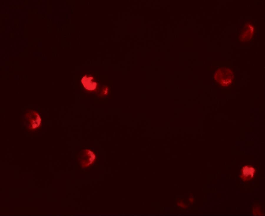 Immunocytochemistry/ Immunofluorescence: p57 Kip2 Antibody [NBP3-27877] - Immunofluorescence of p57 Kip2 in 293 cells with p57 Kip2 antibody at 20 u/mL.