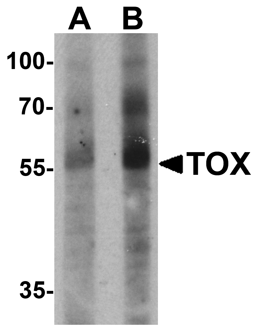 Western Blot: TOX Antibody [NBP3-27880] - Western blot analysis of TOX in human colon tissue lysate with TOX antibody at (A) 1 and (B) 2 u/mL.