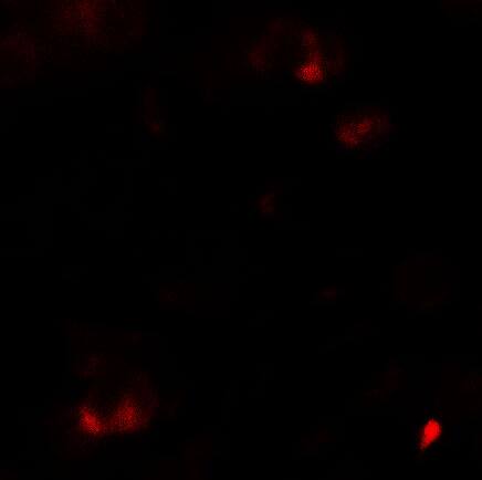 Immunocytochemistry/ Immunofluorescence: SAMSN1 Antibody [NBP3-27881] - Immunofluorescence of SAMSN11 in HeLa cells with SAMSN11 antibody at 5 u/ml.