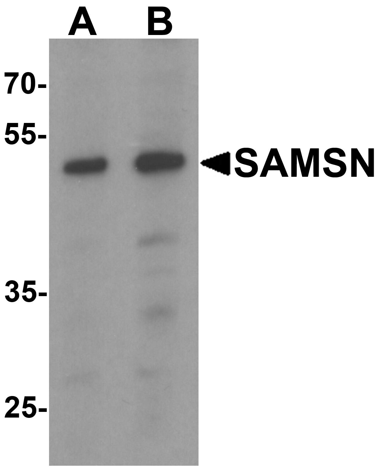 Western Blot: SAMSN1 Antibody [NBP3-27881] - Western blot analysis of SAMSN1 in Hela cell lysate with SAMSN1 antibody at (A) 0.5 and (B) 1 u/mL.