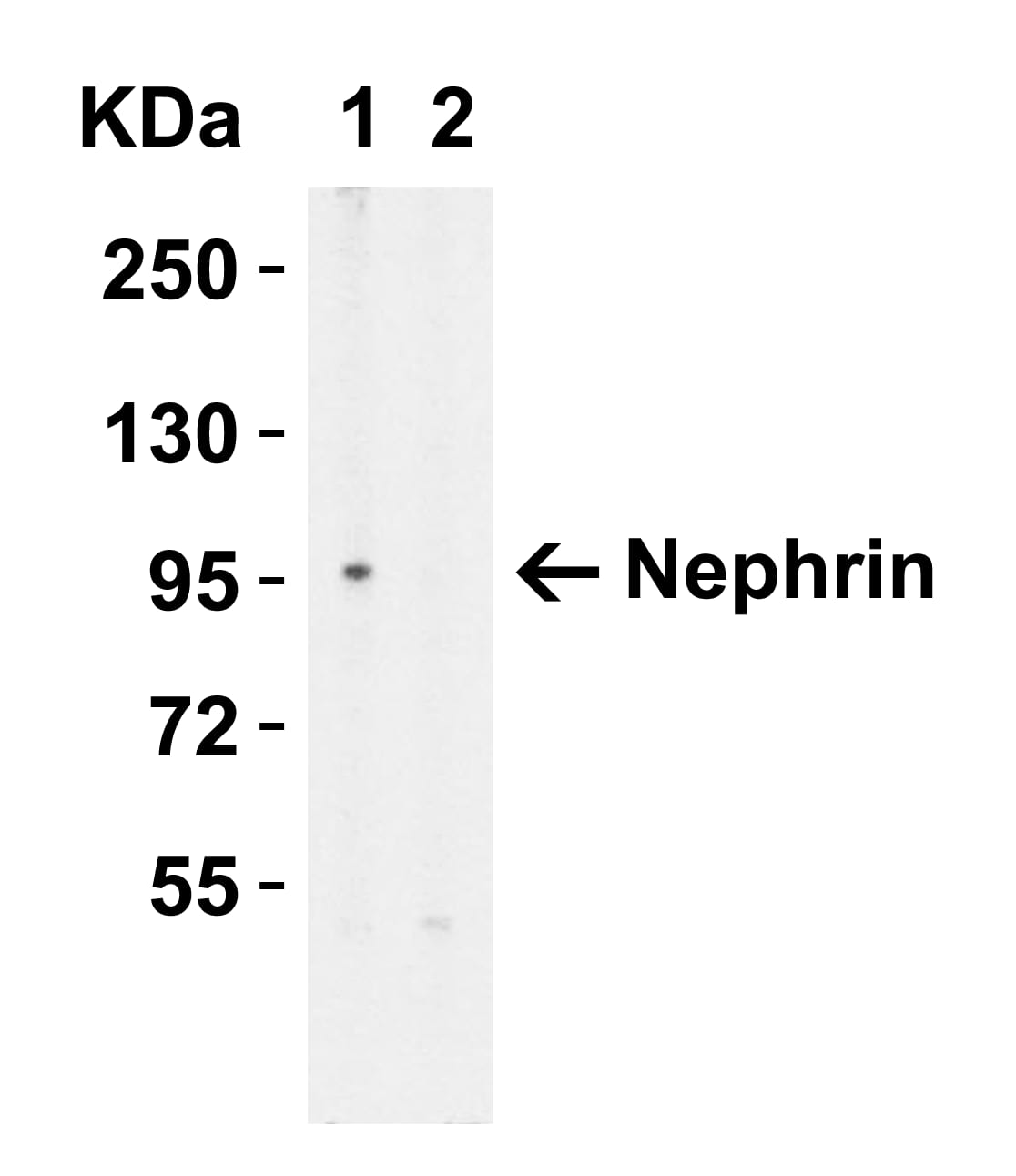 Western Blot: Myosin VIIb Antibody [NBP3-27882] - Figure 1 Western Blot Validation in HeLa Cell Lysate with (A) the Absence and (B) the Presence of Blocking PeptideLoading: 15 u of lysates per lane.Antibodies: Myosin VIIb  (1 u/mL), 1h incubation at RT in 5% NFDM/TBST.Secondary: Goat anti-rabbit IgG HRP conjugate at 1:10000 dilution.