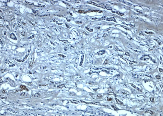 Immunohistochemistry: Myosin VIIb Antibody [NBP3-27882] - Figure 3 Immunohistochemistry Validation of Myosin VIIb in Human Kidney Tissue  Immunohistochemical analysis of paraffin-embedded human kidney tissue using anti-Myosin VIIb antibody  at 5 u/ml. Tissue was fixed with formaldehyde and blocked with 10% serum for 1 h at RT; antigen retrieval was by heat mediation with a citrate buffer (pH6). Samples were incubated with primary antibody overnight at 4C. A goat anti-rabbit IgG H&L (HRP) at 1/250 was used as secondary. Counter stained with Hematoxylin.