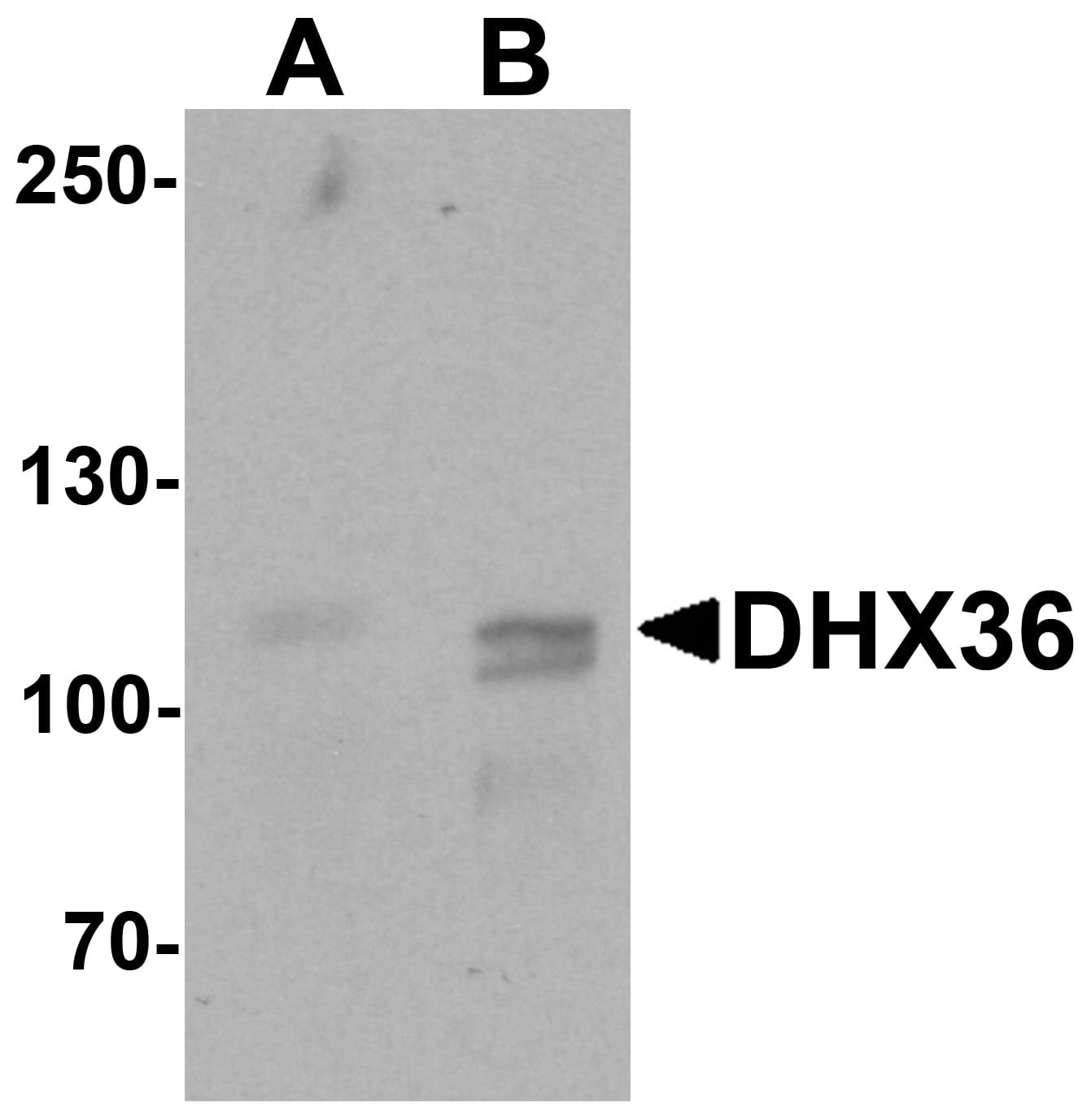 Western Blot: DHX36 Antibody [NBP3-27883] - Western blot analysis of DHX36 in mouse liver tissue lysate with DHX36 antibody at (A) 0.5 and (B) 1 u/mL.