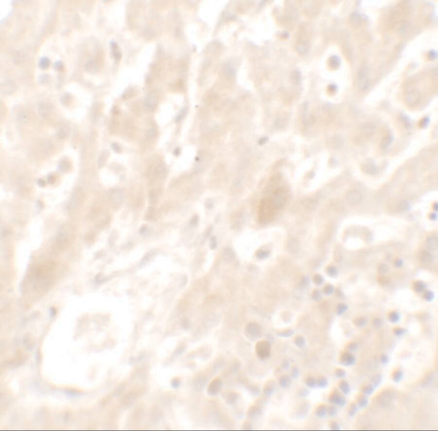 Immunohistochemistry: DHX36 Antibody [NBP3-27883] - Immunohistochemistry of DHX36 in human liver tissue with DHX36 antibody at 5 u/mL.