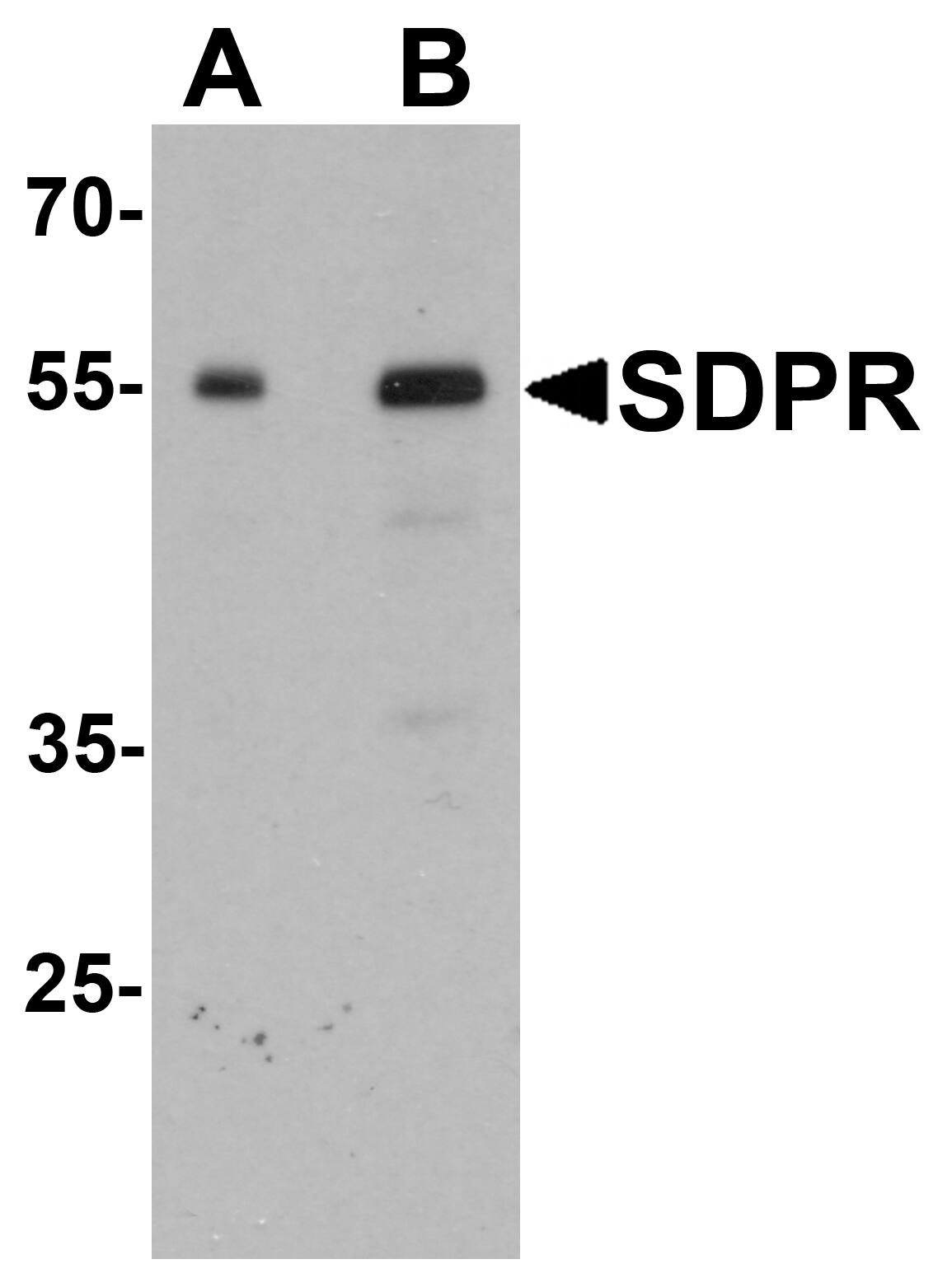 Western Blot: PTRF Antibody [NBP3-27884] - Western blot analysis of PTRF in human spleen tissue lysate with PTRF antibody at (A) 0.5 and (B) 1 u/mL