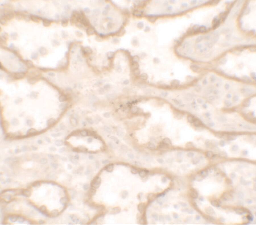 Immunohistochemistry: PTRF Antibody [NBP3-27884] - Immunohistochemistry of PTRF in human spleen tissue with PTRF antibody at 5 u/ml.