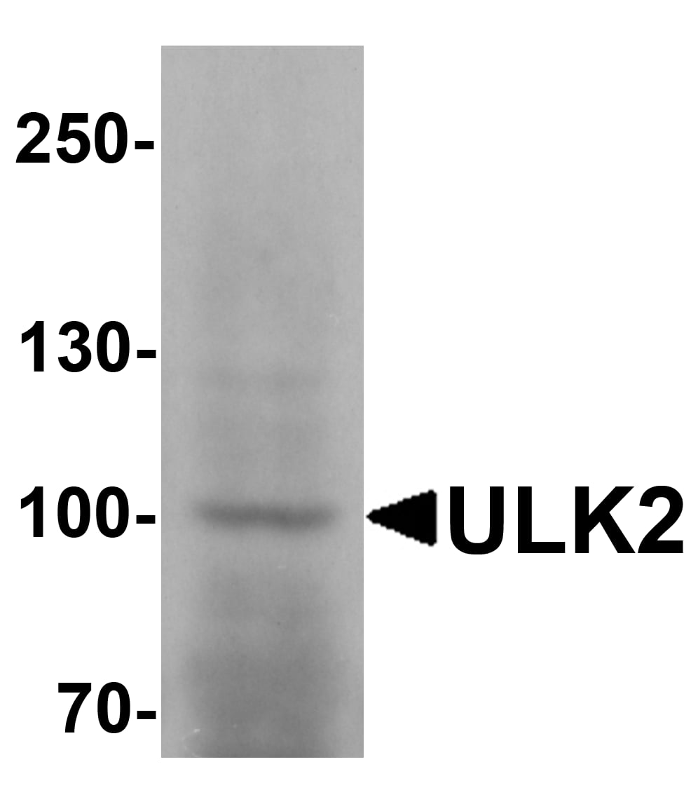 Western Blot: ULK2 Antibody [NBP3-27885] - Western blot analysis of ULK2 in human brain tissue lysate with ULK2 antibody at 1 u/mL.