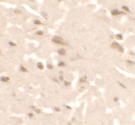 Immunohistochemistry: ULK2 Antibody [NBP3-27885] - Immunohistochemistry of ULK2 in human brain tissue with ULK2 antibody at 2.5 u/ml.