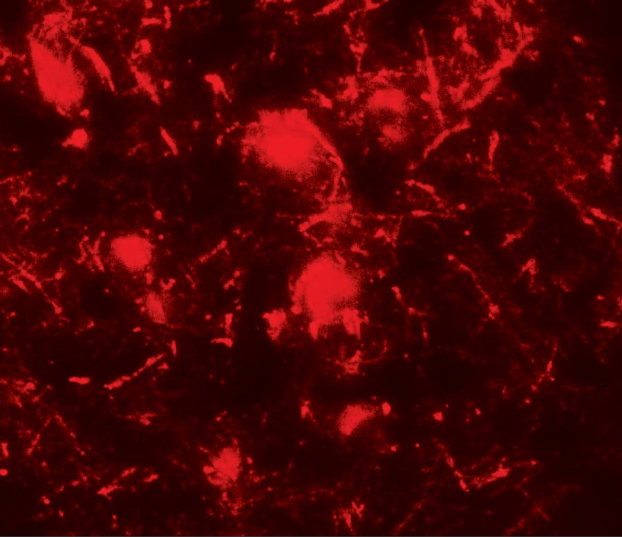 Immunocytochemistry/ Immunofluorescence: ULK2 Antibody [NBP3-27885] - Immunofluorescence of ULK2 in human brain tissue with ULK2 antibody at 20 u/ml.