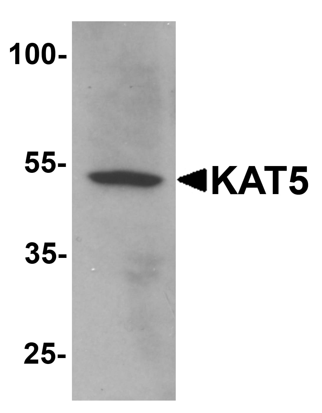 Western Blot: TIP60 Antibody [NBP3-27886] - Western blot analysis of TIP60 in human brain tissue lysate with TIP60 antibody at 1 u/mL.