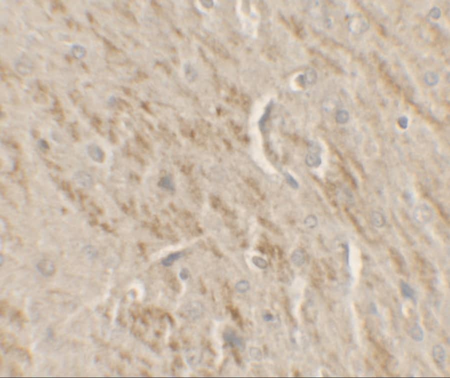 Immunohistochemistry: TIP60 Antibody [NBP3-27886] - Immunohistochemistry of TIP60 in rat brain tissue with TIP60 antibody at 2.5 u/ml.