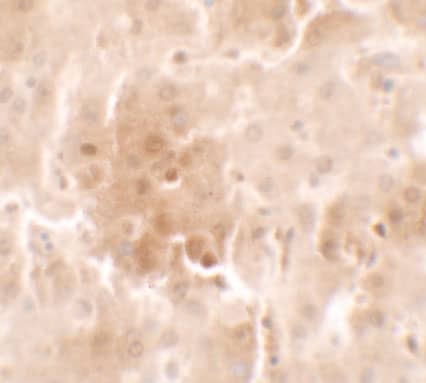 Immunohistochemistry: RNF20 Antibody [NBP3-27887] - Immunohistochemistry of RNF20 in human liver tissue with RNF20 antibody at 2.5 u/ml.