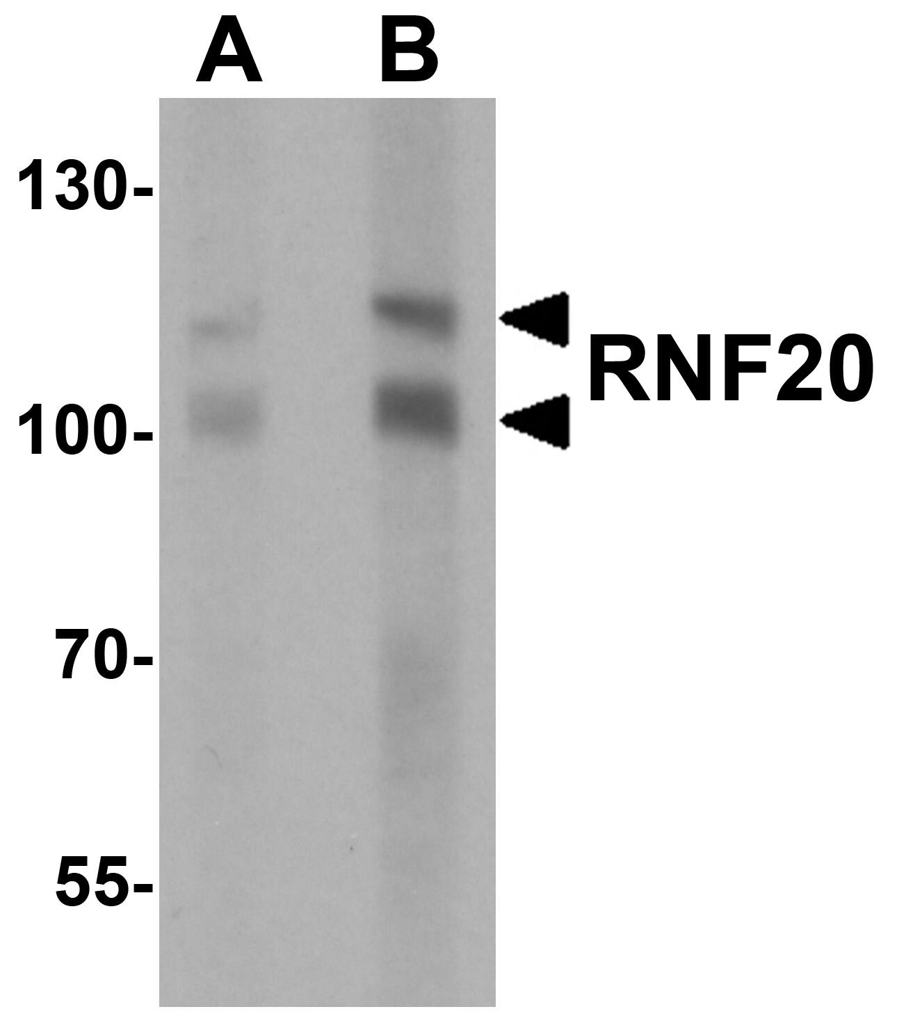 Western Blot: RNF20 Antibody [NBP3-27887] - Western blot analysis of RNF20 in human liver tissue lysate with RNF20 antibody at (A) 1 and (B) 2 u/mL.