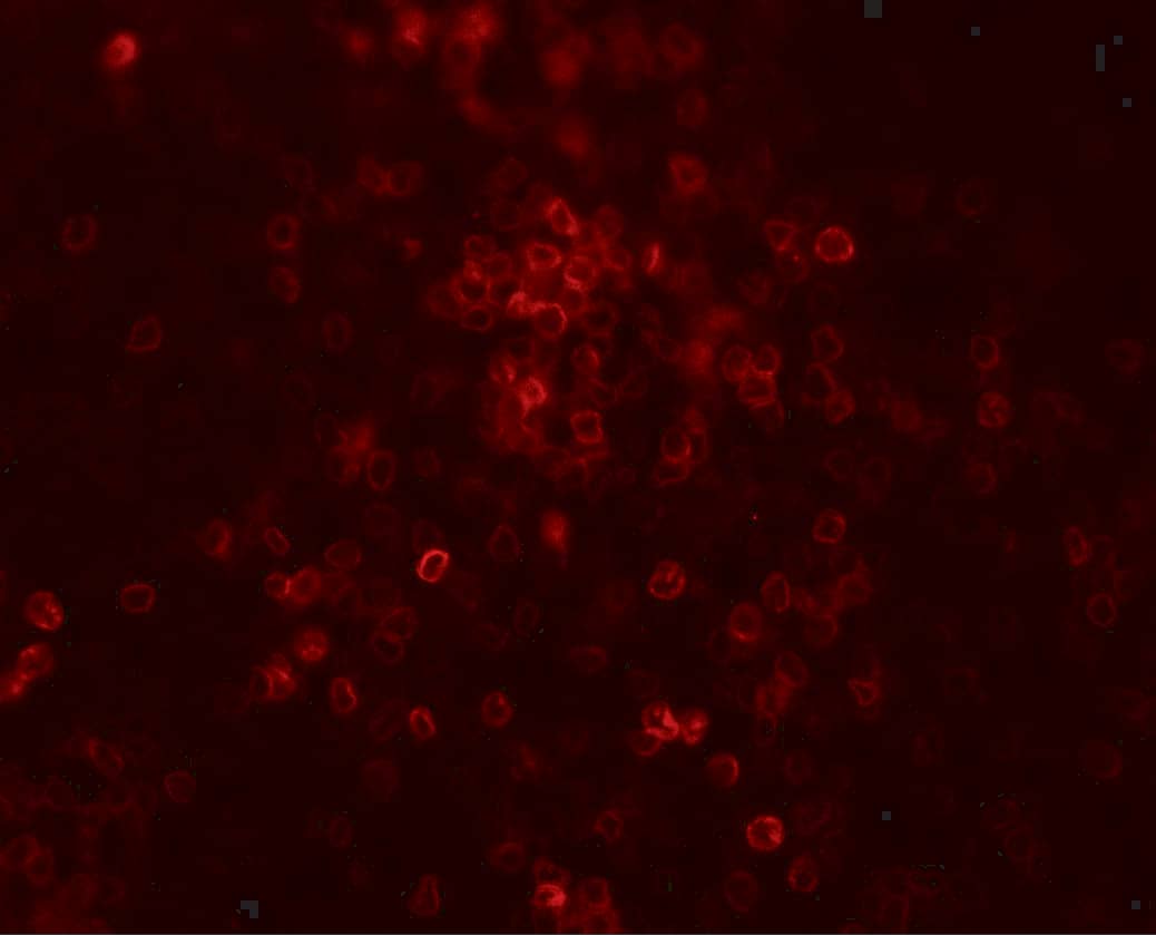 Immunocytochemistry/ Immunofluorescence: TLX3 Antibody [NBP3-27888] - Immunofluorescence of TLX3 in human spleen tissue with TLX3 antibody at 20 u/ml.