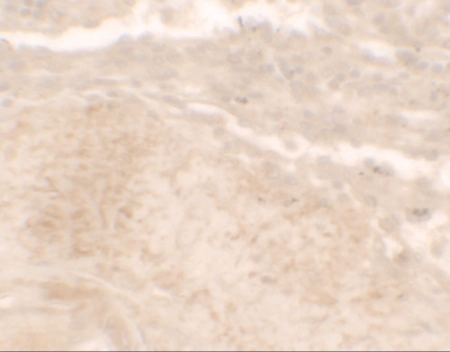 Immunohistochemistry: TLX3 Antibody [NBP3-27888] - Immunohistochemistry of TLX3 in human spleen tissue with TLX3 antibody at 2.5 u/ml.