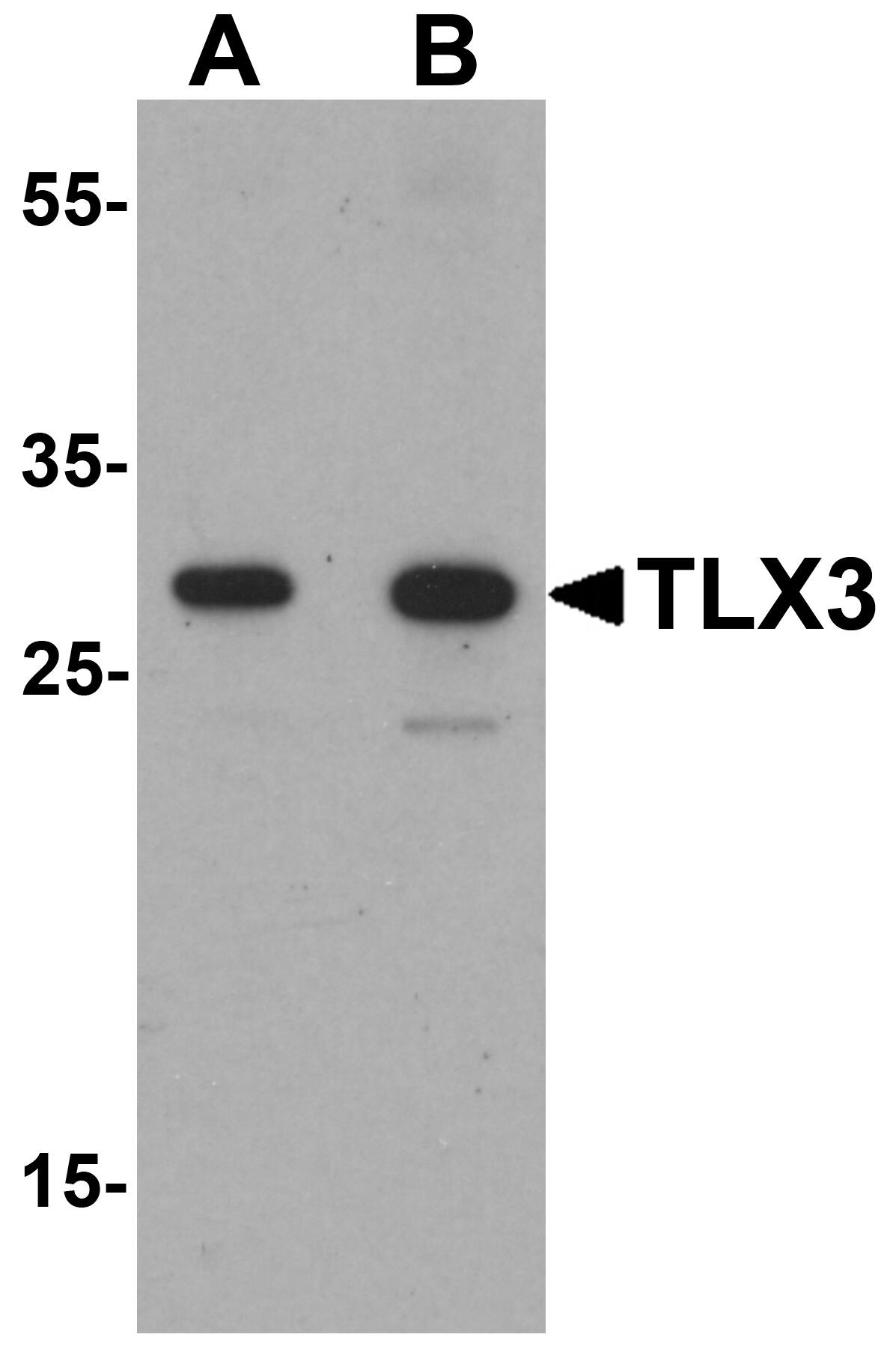 Western Blot: TLX3 Antibody [NBP3-27888] - Western blot analysis of TLX3 in human spleen tissue lysate with TLX3 antibody at (A) 0.5 and (B) 1 u/mL.