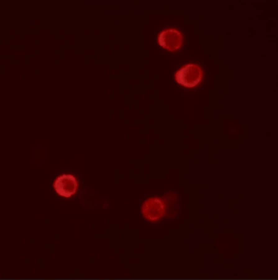 Immunocytochemistry/ Immunofluorescence: FHIT Antibody [NBP3-27889] - Immunofluorescence of FHIT in HeLa cells with FHIT antibody at 5 u/mL.