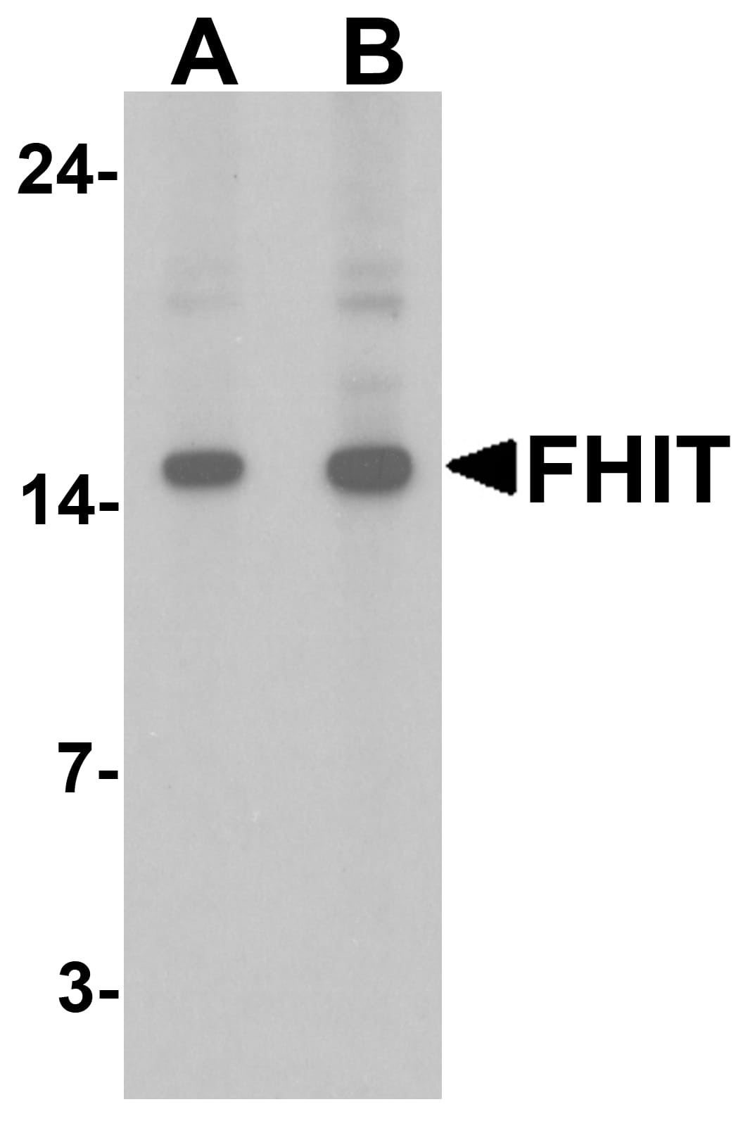 Western Blot: FHIT Antibody [NBP3-27889] - Western blot analysis of FHIT in HeLa cell lysate with FHIT antibody at (A) 1 and (B) 2 u/ml.