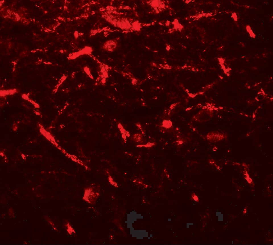 Immunocytochemistry/ Immunofluorescence: FMRP Antibody [NBP3-27890] - Immunofluorescence of FMRP in human brain tissue with FMRP antibody at 20 u/mL.