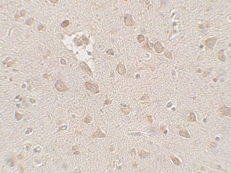 Immunohistochemistry: FMRP Antibody [NBP3-27890] - Immunohistochemistry of FMRP in human brain tissue with FMRP antibody at 2.5 u/mL.