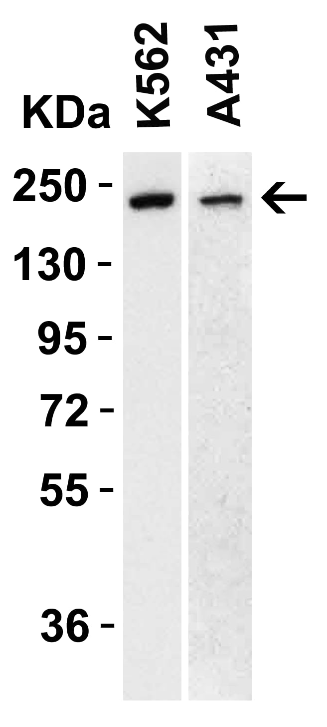 Western Blot: TET1 Antibody [NBP3-27892] - Figure 1 WB Validation  of TET1 in Human Cell Lines Loading: 15 u of lysate Antibodies:  TET1 , 1 u/mL , 1 h incubation at RT in 5% NFDM/TBST. Secondary: Goat Anti-Rabbit IgG HRP conjugate at 1:10000 dilution.