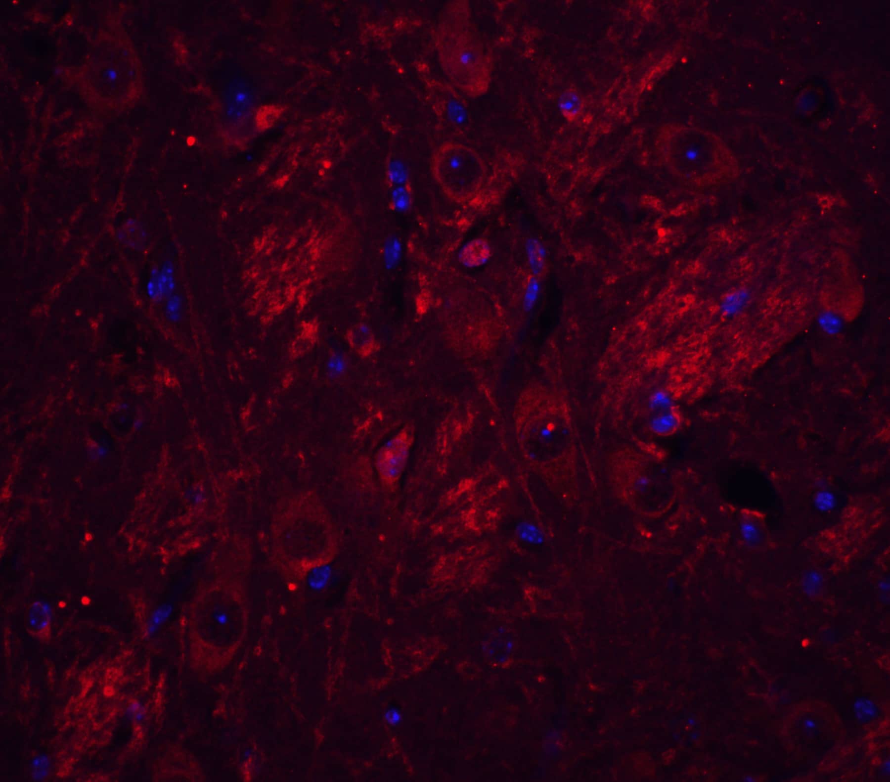 Immunocytochemistry/ Immunofluorescence: TET1 Antibody [NBP3-27892] - Figure 5Immunofluorescence Validation of TET1 in Mouse Brain TissueImmunofluorescent analysis of 4% paraformaldehyde-fixed mouse brain tissue labeling TET1 with  at 20 u/mL, followed by goat anti-rabbit IgG secondary antibody at 1/500 dilution (red) and DAPI antibody (blue).  