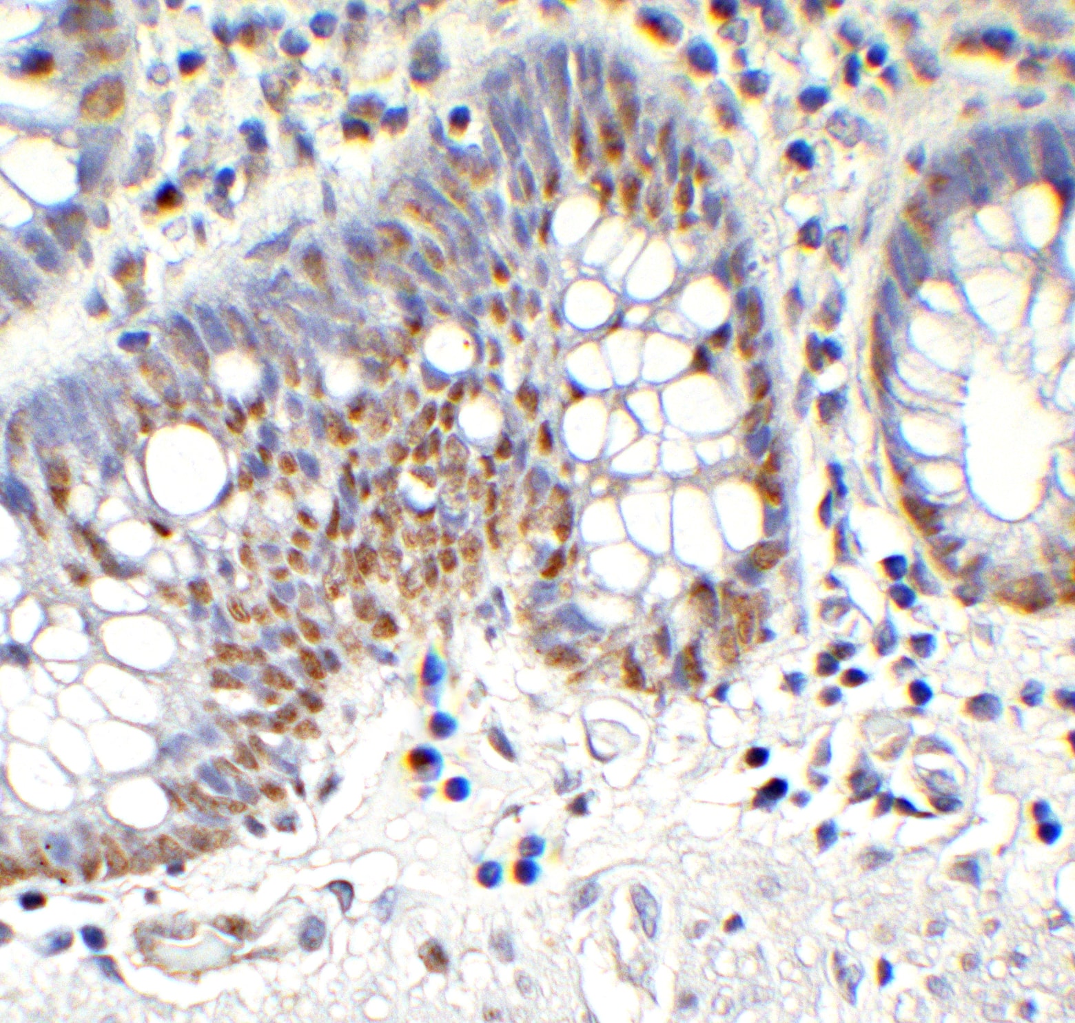 Immunohistochemistry: TET1 Antibody [NBP3-27892] -  Figure 6 Immunohistochemistry Validation of TET1 in Human Testis Tissue  Immunohistochemical analysis of paraffin-embedded human testis tissue using anti-TET1 antibody  at 1 u/ml. Tissue was fixed with formaldehyde and blocked with 10% serum for 1 h at RT; antigen retrieval was by heat mediation with a citrate buffer (pH6). Samples were incubated with primary antibody overnight at 4C. A goat anti-rabbit IgG H&L (HRP) at 1/250 was used as secondary. Counter stained with Hematoxylin.