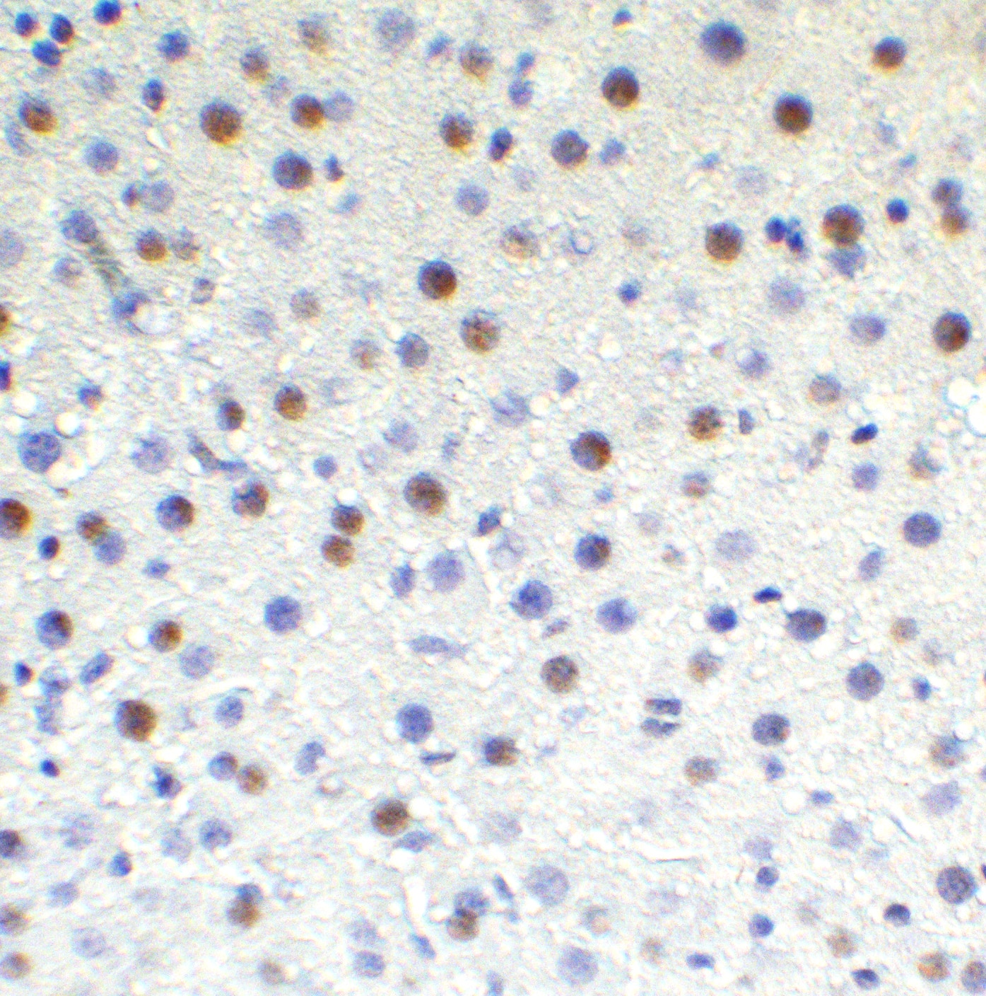 Immunohistochemistry: TET1 Antibody [NBP3-27892] - Figure 8 Immunohistochemistry Validation of TET1 in Rat Liver Tissue  Immunohistochemical analysis of paraffin-embedded rat liver tissue using anti-TET1 antibody  at 1 u /ml. Tissue was fixed with formaldehyde and blocked with 10% serum for 1 h at RT; antigen retrieval was by heat mediation with a citrate buffer (pH6). Samples were incubated with primary antibody overnight at 4C. A goat anti-rabbit IgG H&L (HRP) at 1/250 was used as secondary. Counter stained with Hematoxylin.