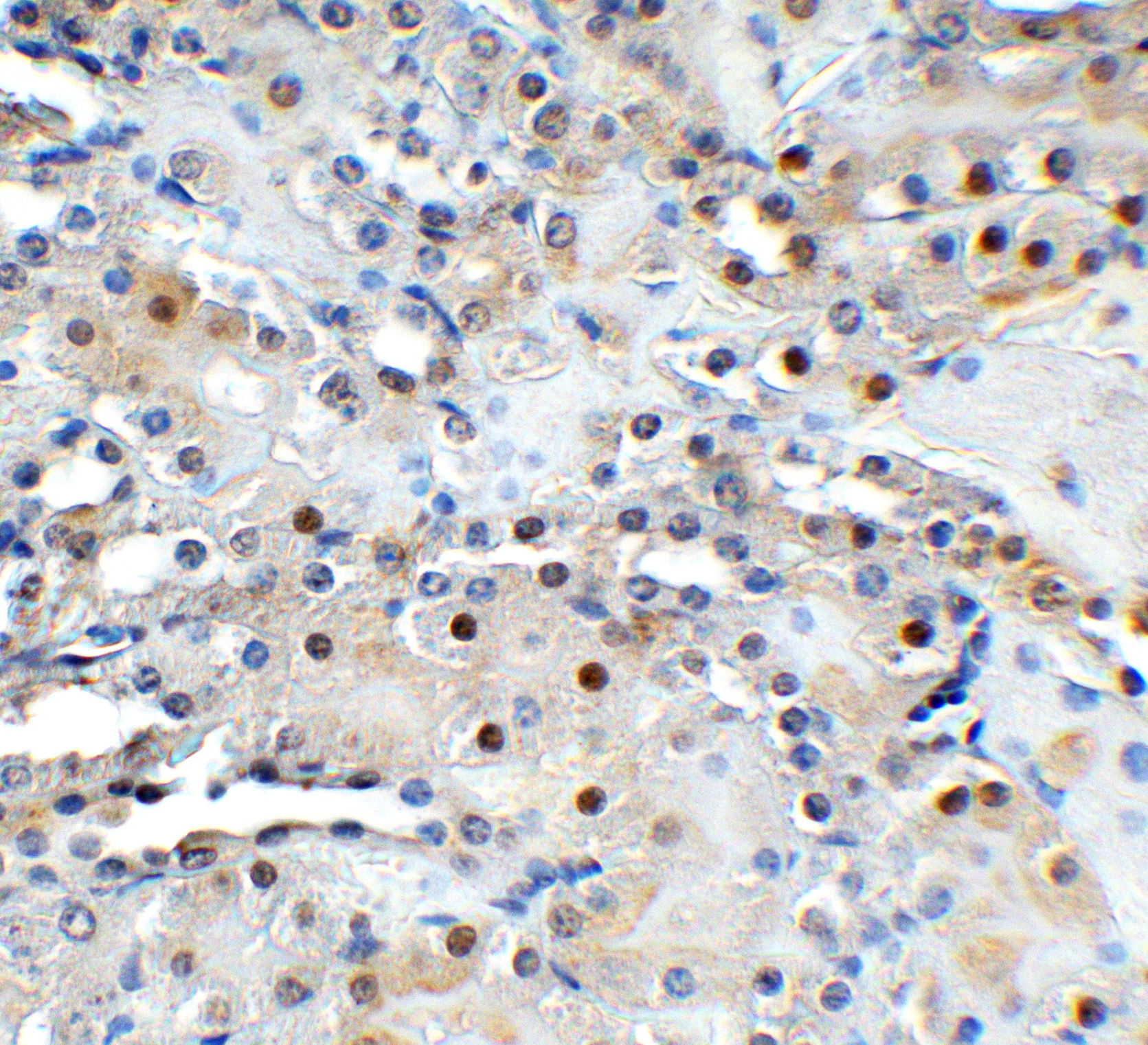 Immunohistochemistry: TET1 Antibody [NBP3-27892] - Figure 7  Immunohistochemistry Validation of TET1 in Mouse Kidney Tissue  Immunohistochemical analysis of paraffin-embedded mouse kidney tissue using anti-TET1 antibody  at 1 u /ml. Tissue was fixed with formaldehyde and blocked with 10% serum for 1 h at RT; antigen retrieval was by heat mediation with a citrate buffer (pH6). Samples were incubated with primary antibody overnight at 4C. A goat anti-rabbit IgG H&L (HRP) at 1/250 was used as secondary. Counter stained with Hematoxylin.