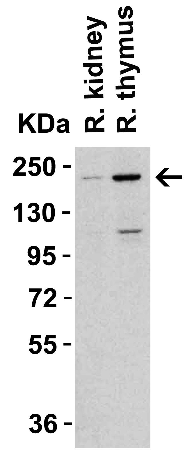 Western Blot: TET1 Antibody [NBP3-27892] - Figure 3 WB Validation of TET1 in Rat Tissues  Loading: 15 u of lysate Antibodies:  TET1 , 1 u/mL , 1 h incubation at RT in 5% NFDM/TBST. Secondary: Goat Anti-Rabbit IgG HRP conjugate at 1:10000 dilution.