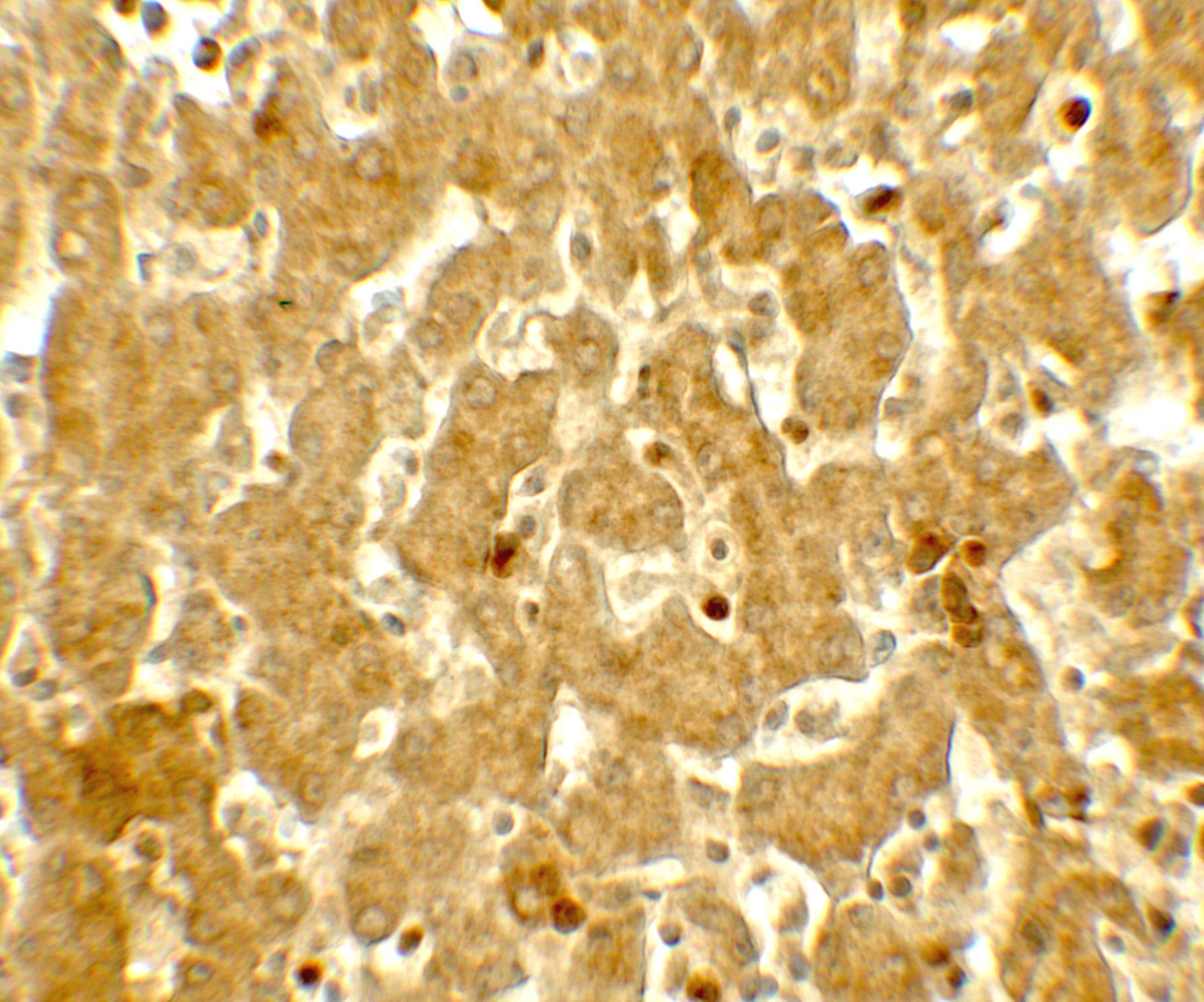 Immunohistochemistry: IFIT3 Antibody [NBP3-27893] - Immunohistochemistry of IFIT3 in human liver tissue with IFIT3 antibody at 5 u/mL.