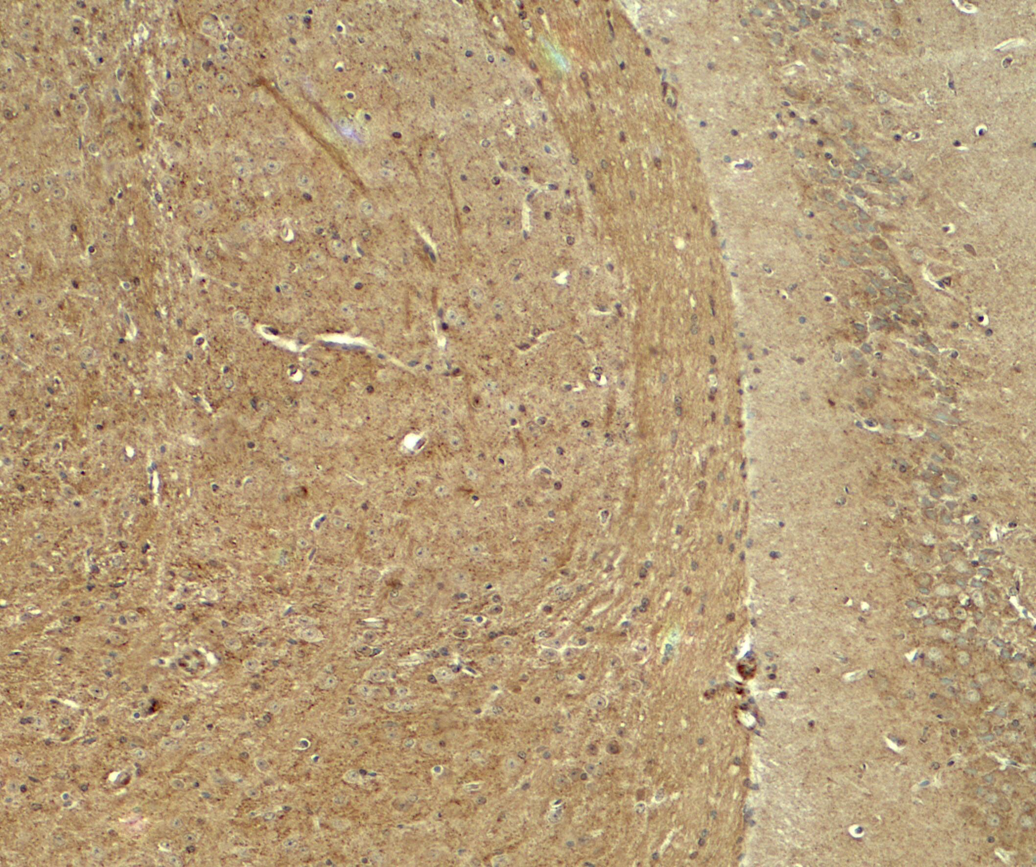 Immunohistochemistry: WDR61 Antibody [NBP3-27894] - Immunohistochemistry of WDR61 in mouse brain tissue with WDR61 antibody at 5 u/ml.