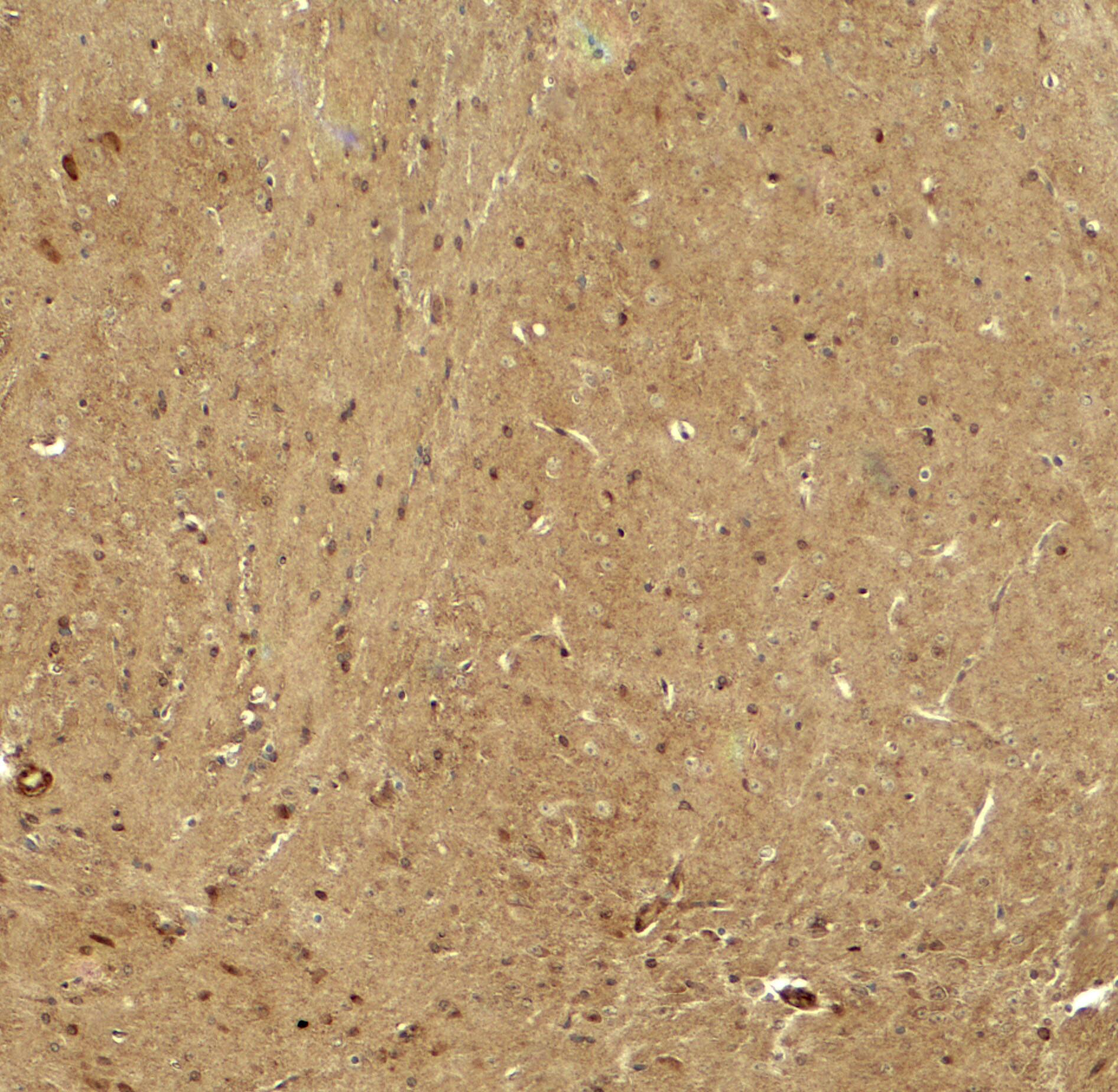 Immunohistochemistry: Rhot1 Antibody [NBP3-27895] - Immunohistochemistry of RHOT in mouse brain tissue with RHOT antibody at 5 u/ml.