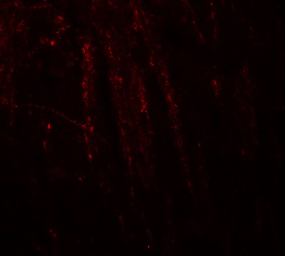 Immunocytochemistry/ Immunofluorescence: Rhot1 Antibody [NBP3-27895] - Immunofluorescence of RHOT in mouse brain tissue with RHOT antibody at 20 u/ml.