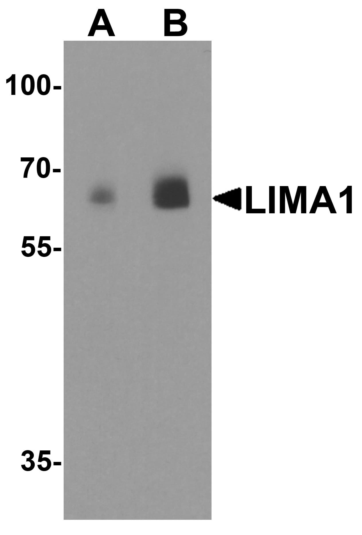 Western Blot: EPLIN Antibody [NBP3-27896] - Western blot analysis of EPLIN in human colon tissue lysate with EPLIN antibody at (A) 0.5 and (B) 1 u/ml.