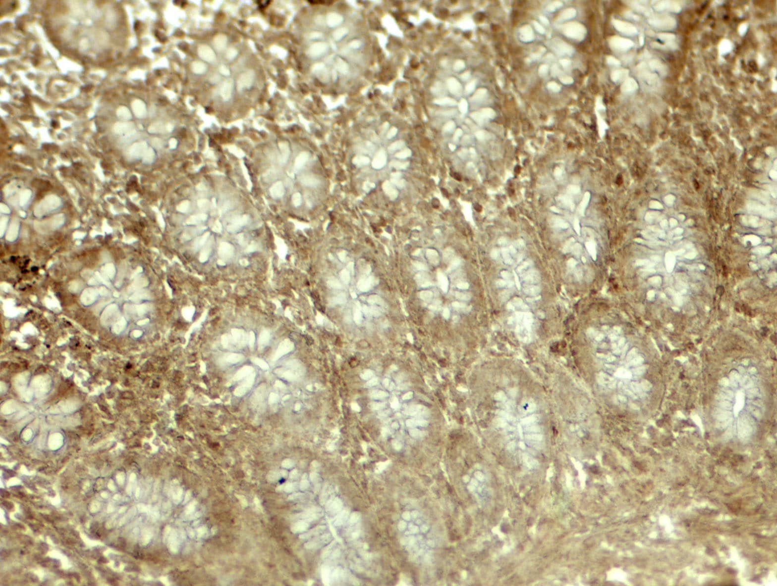 Immunohistochemistry: EPLIN Antibody [NBP3-27896] - Immunohistochemistry of EPLIN in human colon tissue with EPLIN antibody at 5 u/mL.