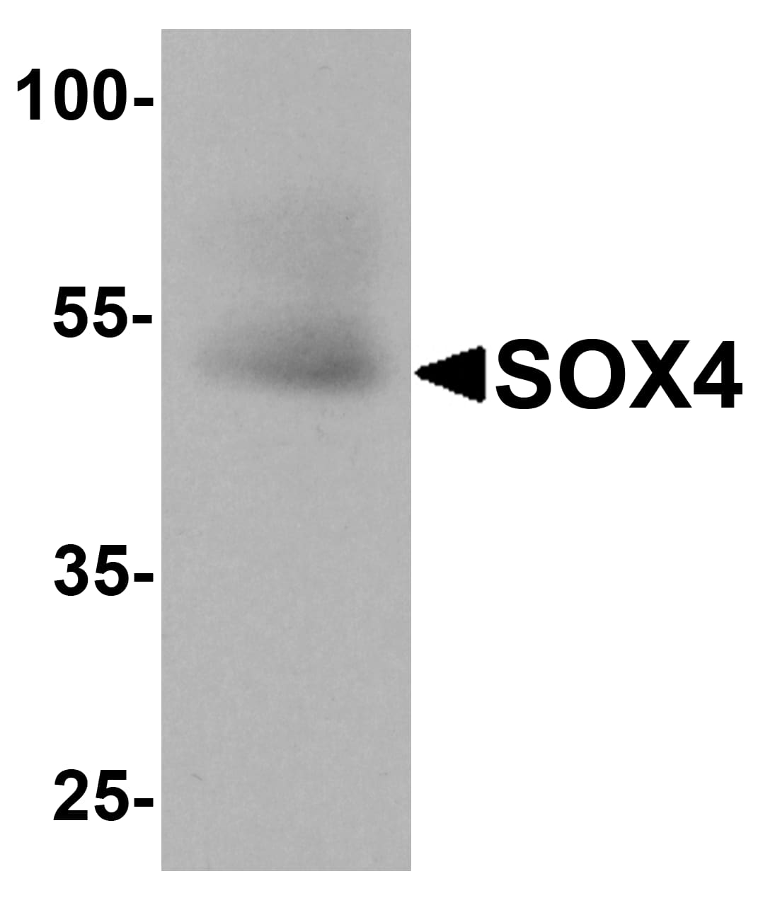 Western Blot: SOX4 Antibody [NBP3-27897] - Western blot analysis of SOX4 in human testis tissue lysate with SOX4 antibody at 1 u/ml.