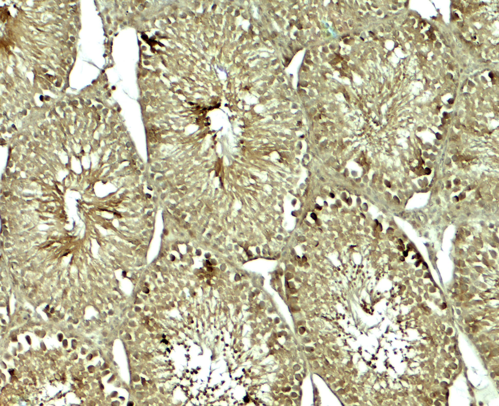 Immunohistochemistry: SOX4 Antibody [NBP3-27897] - Immunohistochemistry of SOX4 in rat testis tissue with SOX4 antibody at 5 u/mL.