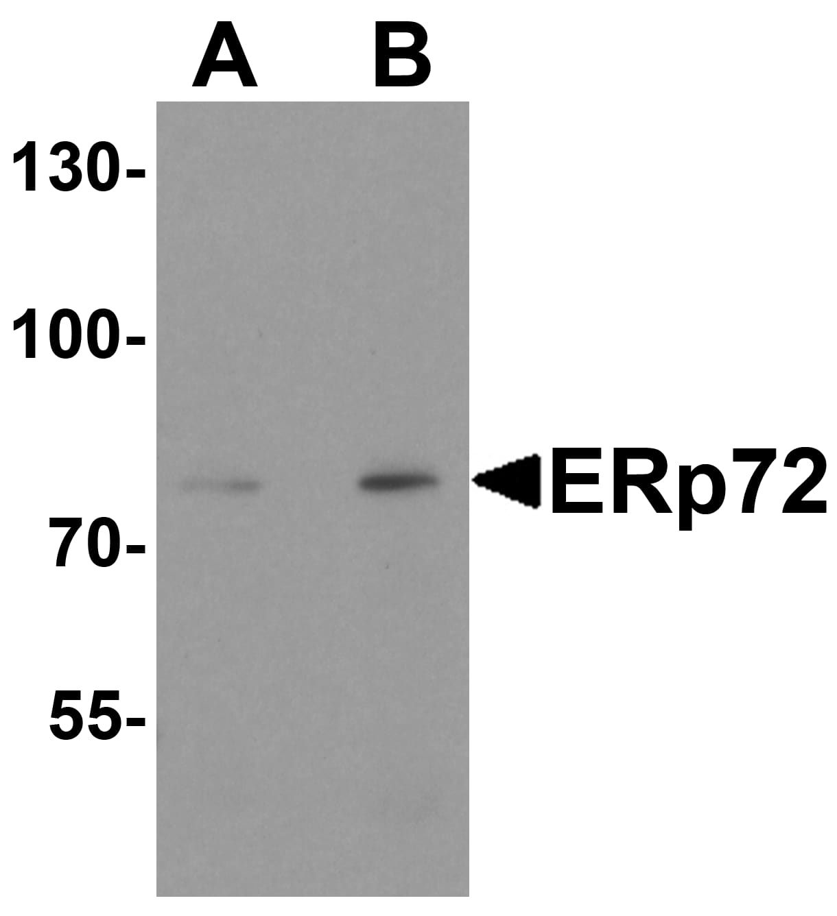 Western Blot: ERp72 Antibody [NBP3-27898] - Western blot analysis of ERp72 in human colon tissue lysate with ERp72 antibody at (A) 1 and (B) 2 u/ml.