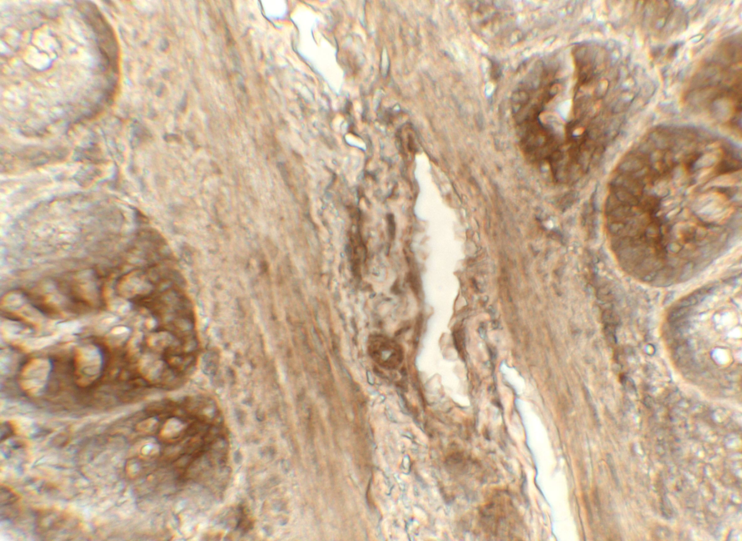 Immunohistochemistry: ERp72 Antibody [NBP3-27898] - Immunohistochemistry of ERp72 in rat colon tissue with ERp72 antibody at 5 u/mL.