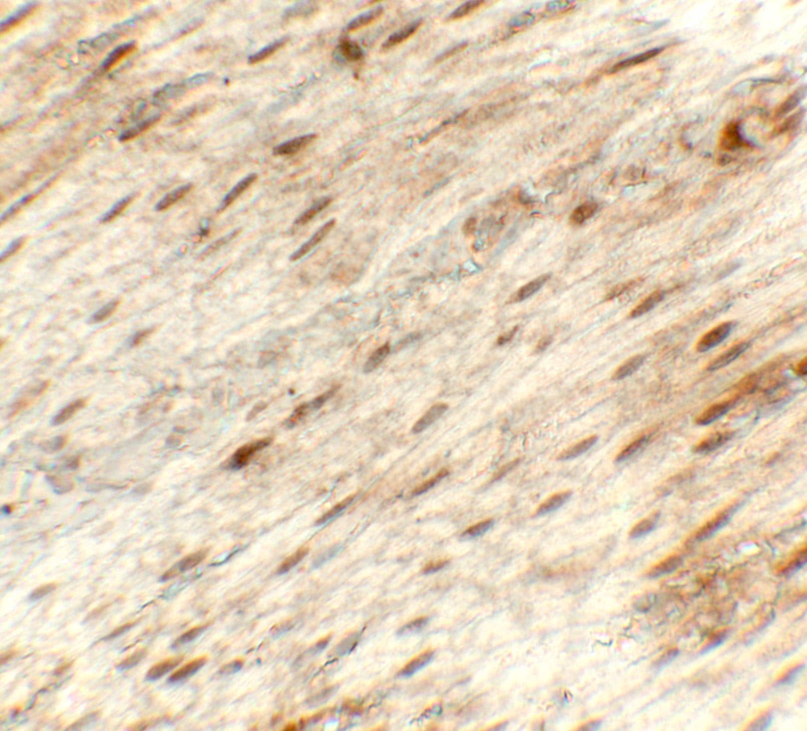 Immunohistochemistry: Hexokinase 1 Antibody [NBP3-27899] - Immunohistochemistry of Hexokinase 1 in rat stomach tissue with Hexokinase 1 antibody at 5 u/mL.