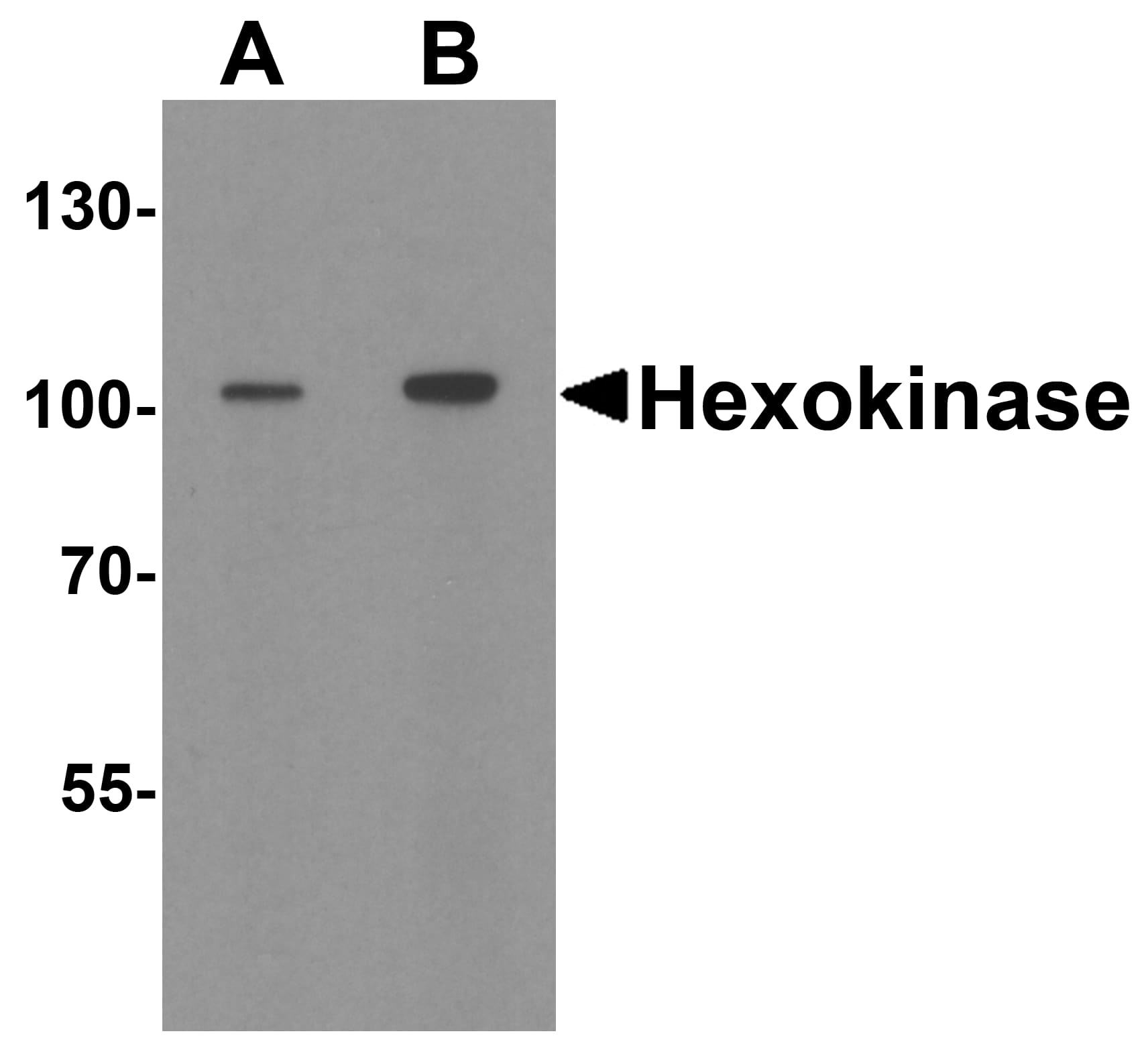 Western Blot: Hexokinase 1 Antibody [NBP3-27899] - Western blot analysis of Hexokinase 1 in rat bladder tissue lysate with Hexokinase 1 antibody at (A) 1 and (B) 2 u/ml.