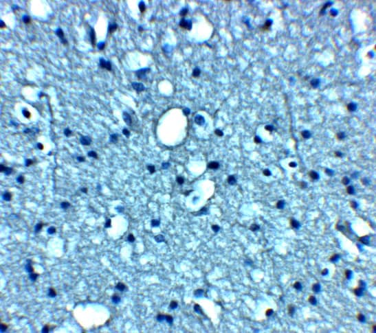 Immunohistochemistry: VTI1B Antibody [NBP3-27901] - Immunohistochemistry of VTI1B in human brain tissue with VTI1B antibody at 5 u/mL.