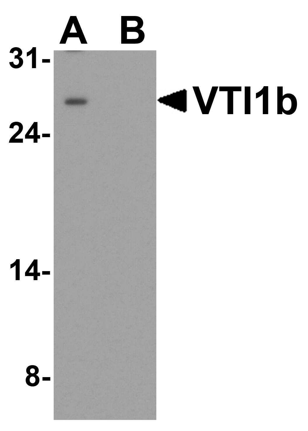 Western Blot: VTI1B Antibody [NBP3-27901] - Western blot analysis of VTI1B in HeLa cell lysate with VTI1B antibody at 1 u/ml in (A) the absence and (B) the presence of blocking peptide.