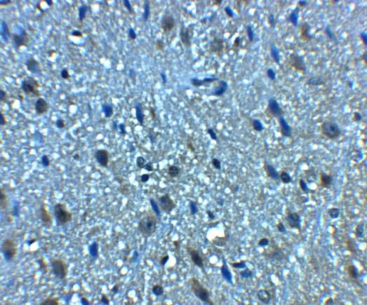 Immunohistochemistry: BTF Antibody [NBP3-27902] - Immunohistochemistry of BTF in mouse brain tissue with BTF antibody at 5 u/mL.