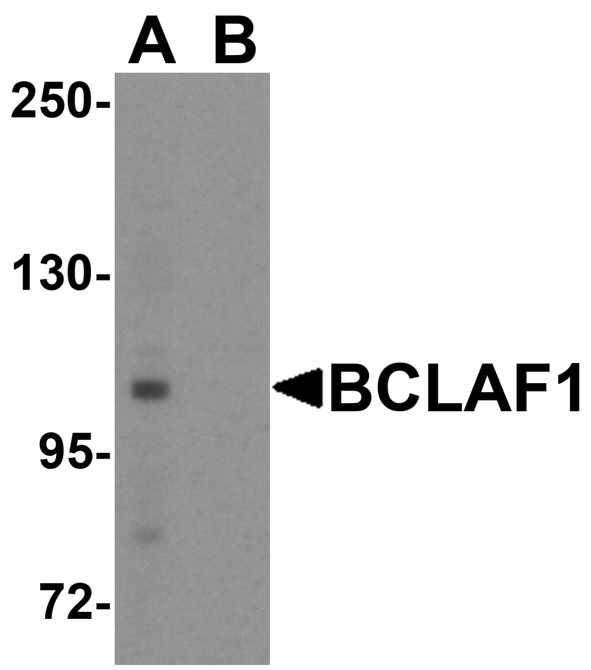 Western Blot: BTF Antibody [NBP3-27902] - Western blot analysis of BTF in human brain tissue lysate with BTF antibody at 1 u/ml.