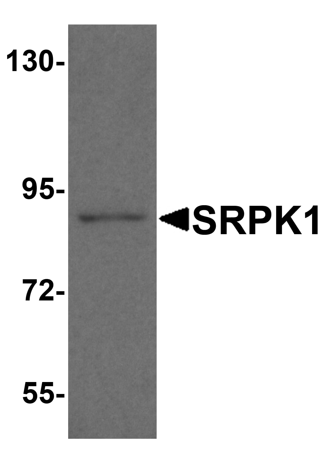 Western Blot: SRPK1 Antibody [NBP3-27903] - Western blot analysis of SRPK1 in mouse heart tissue lysate with SRPK1 antibody at 1 u/ml.