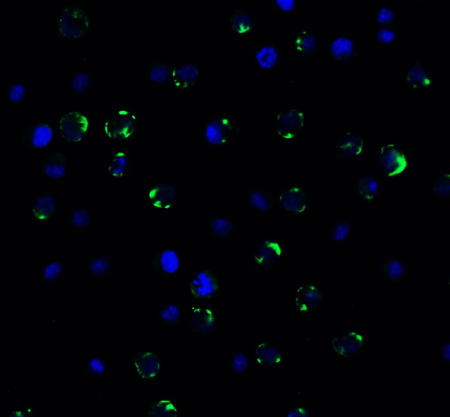 Immunocytochemistry/ Immunofluorescence: PEX3 Antibody [NBP3-27906] -Immunofluorescent analysis of 4% paraformaldehyde-fixed HeLa cells labeling PEX3 at 20 u/mL, followed by goat anti-rabbit IgG secondary antibody at 1/500 dilution (green) and DAPI staining (blue).