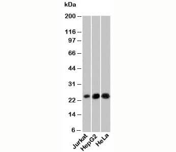 Western Blot: NKIRAS1 Antibody (NRAS285) [NBP3-27916] - Western blot testing of human samples with NKIRAS1 antibody at 6ug/ml.